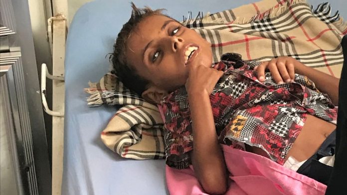 skynews-adam-malnutrition-yemen_4479442